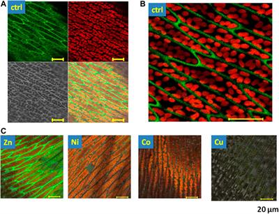 Biosensing the Presence of Metal Nanoparticles by Spectrally- and Time-Resolved Endogenous Fluorescence in Water Moss Fontinalis antipyretica